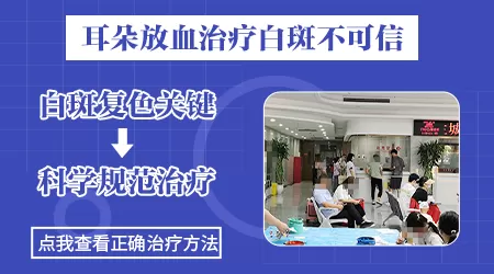 白癜风割耳朵放血有效果吗 割什么位置