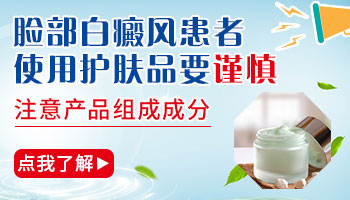 白癜风能做光子嫩肤吗