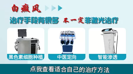 长白斑可以激光吗 激光怎么收费