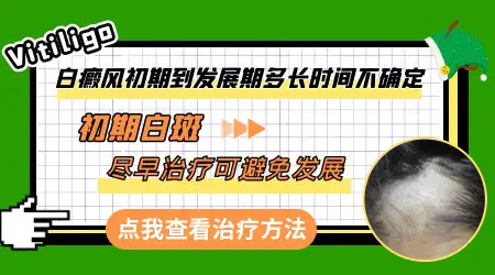 白癜风一般多久不会再扩散