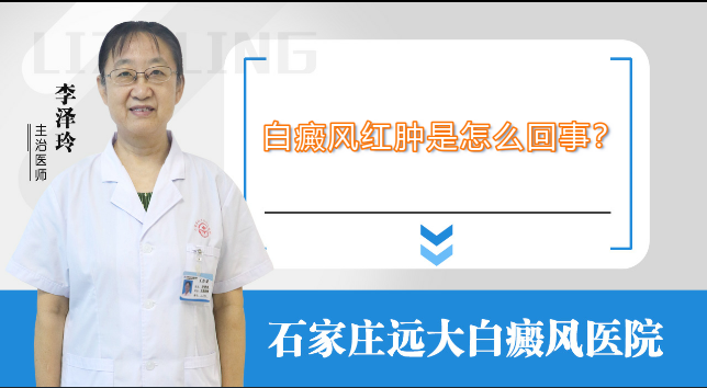 白癜风红肿是怎么回事
