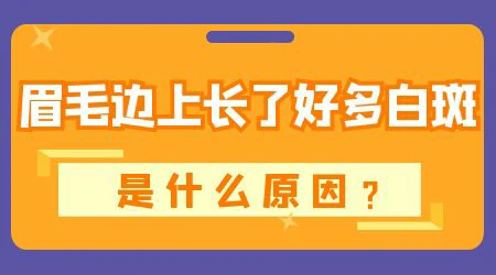 眉毛旁长了一块白怎么分辨是哪种白斑