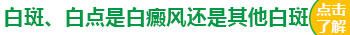 一岁宝宝脚底有白点是不是白癜风