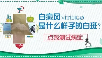 白癜风表面会凸起吗