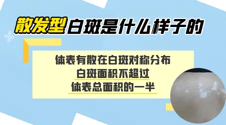 白斑面积占体表面积5%属于轻度还是中度