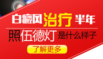 白斑在伍德灯下显示白色是不是白癜风