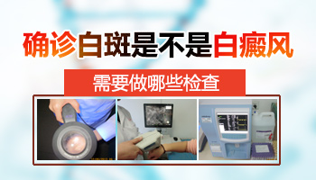医院通过什么仪器确诊白斑是白癜风