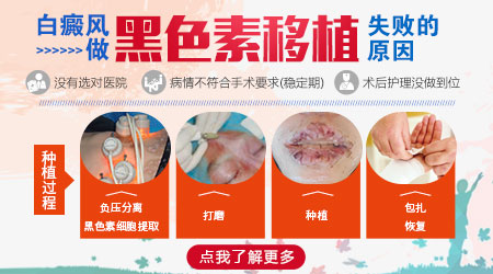 白癜风移植术后两月还有点白怎么回事