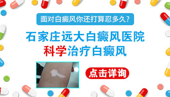 白癜风五六年了没怎么变大需要治疗吗