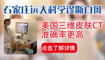 孩子的嘴角边发白是白癜风吗