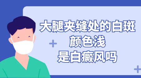 白斑出现快一年了一直没增多是白癜风吗