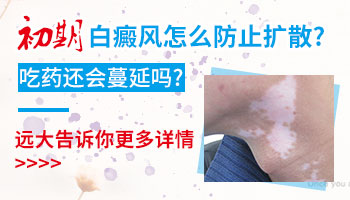 吃药后白癜风还在扩散什么情况
