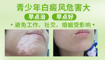 青少年手背有一小块变白是怎么了