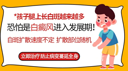 孩子腿上有白斑越长越多