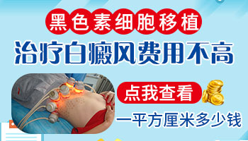 治疗白癜风皮肤移植费用是多少