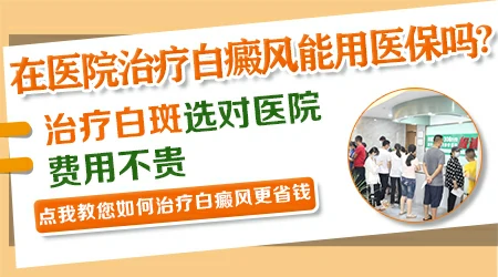 白癜风治疗能不能入医保？