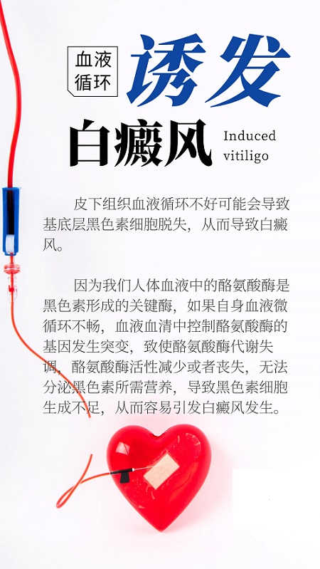 血液循环不好会导致白癜风吗