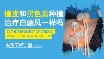 白癜风黑色素种植和植皮一样吗