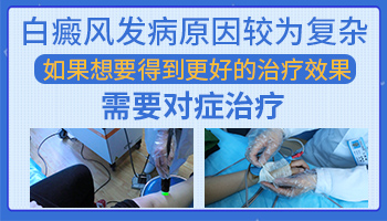 伍德灯检查白斑什么样的白斑是白癜风