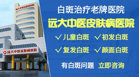 石家庄周边治疗白癜风的医院哪家好
