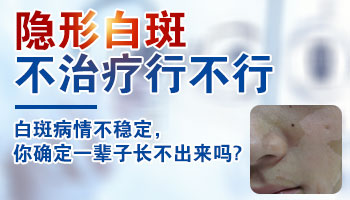 白癜风肉眼看不出来需要照灯吗