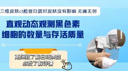 三维皮肤ct检查白斑准确度高吗
