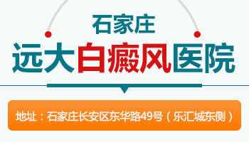 沧州哪家医院治儿童白癜风治的好