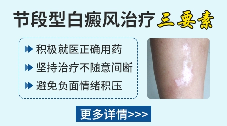 节段型白癜风该如何注意？