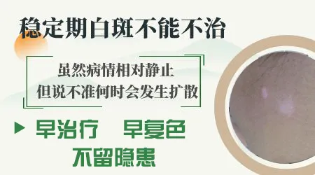 稳定期的白癜风做表皮移植手术靠谱吗