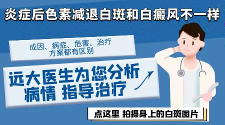 炎症后色素减退出现白斑会恢复吗