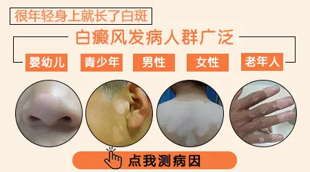 儿童额头发际线处皮肤很白