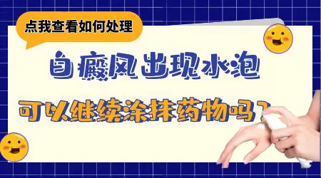白癜风用药期间出现瘙痒水疱要停药吗
