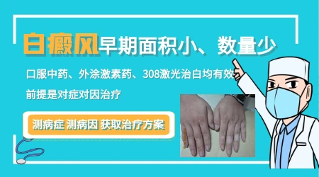 白斑面积很小需要立刻治疗吗