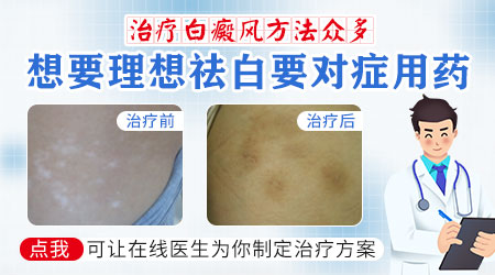 白癜风的并发症有哪些