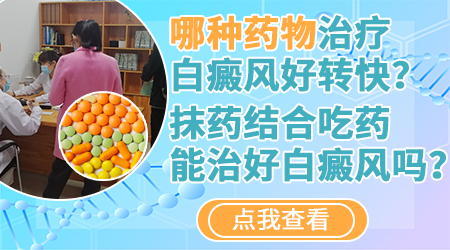 白癜风用什么药好 常用药品都有哪些