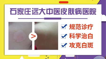 皮肤长小白点不痛不痒是什么病