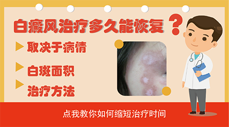 轻微的白癜风多久能治好 大概花多少钱