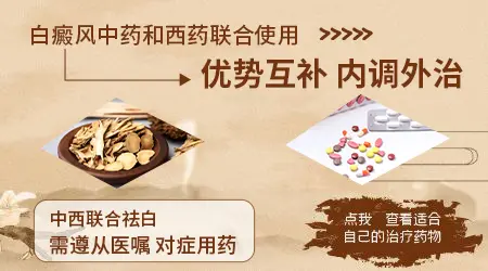 白癜风中药和西药能不能一起用