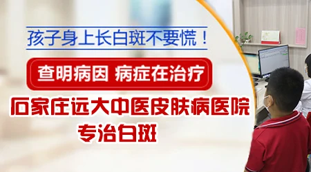 小孩手指上有白斑是什么原因