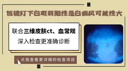 伍德灯结果里的可疑阳性是什么意思