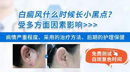 白癜风光疗每次需要照多长时间