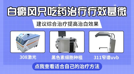 白癜风只吃药和抹药能好吗