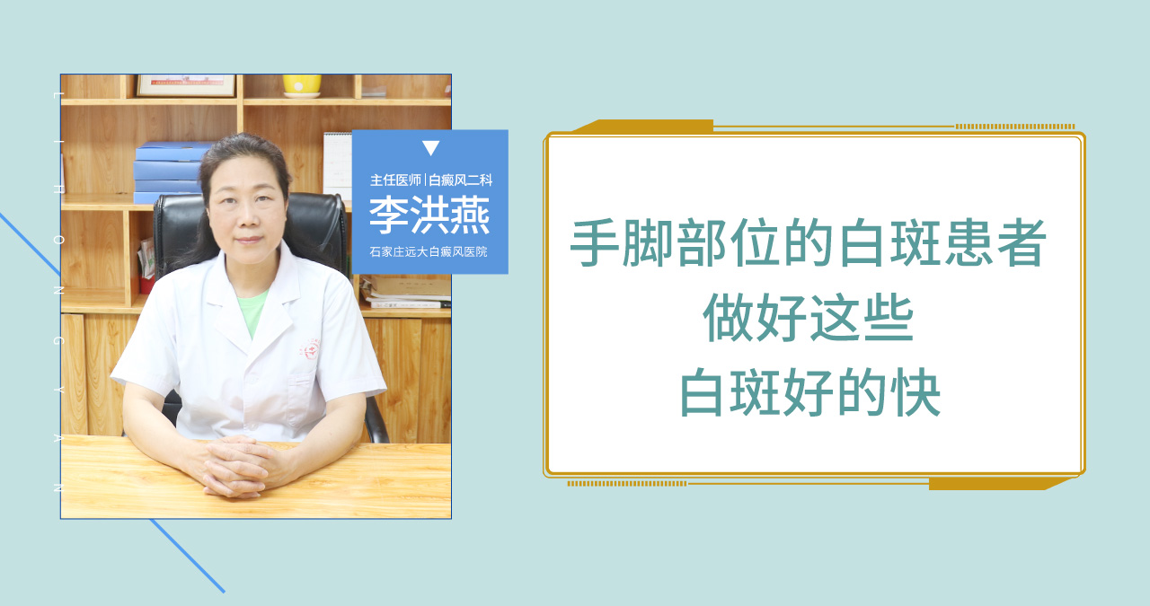 手脚部位的白斑患者做好这些事白斑好的快