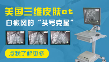 美国三维皮肤ct哪些医院有 检查白斑一次多少钱
