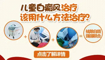 孩子有白癜风接种流感疫苗期间用停药吗