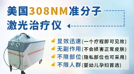 怀孕期间白斑扩散怎么办 能继续治疗吗