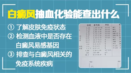 白癜风验血可以查诱因吗