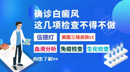 用伍德灯检查白斑会有误差吗
