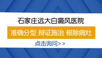 河北保定治疗白癜风哪家医院好