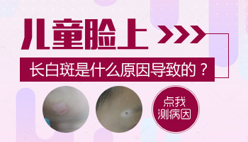 儿童脸部白斑怎么回事